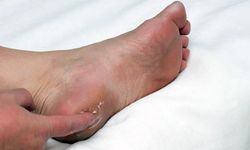 Prof. Dr. Karalezli’den topuk dikeni uyarısı