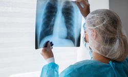 Türkiye’de tüberküloz vakaları 19 yılda yüzde 65 azaldı