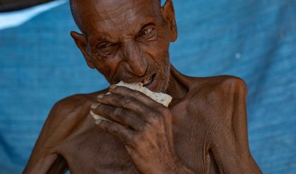 Gazze’de 5 sivil daha açlık nedeniyle hayatını kaybetti