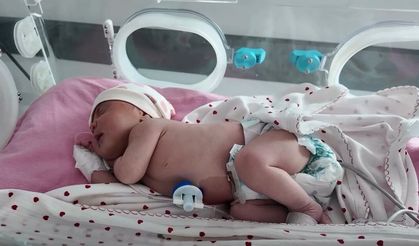 Bebeklerde Topuk Kanı taraması hayat kurtarıyor