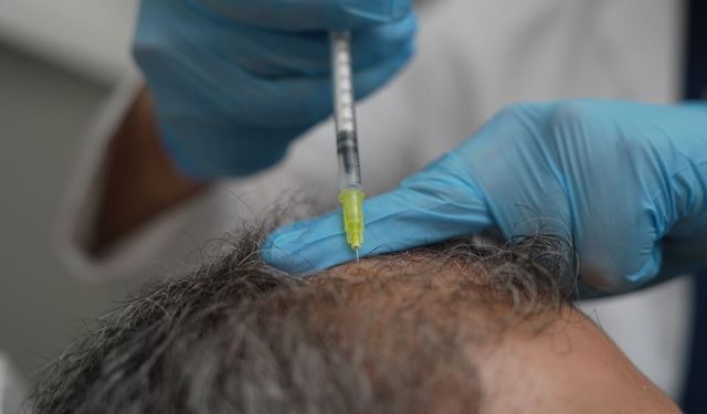 Dökülen saçlar vücudun bir alarmı olabilir