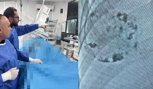 Niğde’de karaciğer tümörü ameliyatsız tedavi edildi