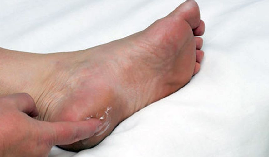 Prof. Dr. Karalezli’den topuk dikeni uyarısı