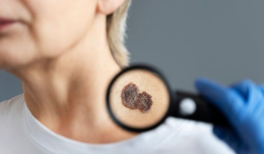 Uzmanı uyardı: Baharda cilt hastalıkları artıyor